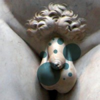 cáncer pene Balanitis