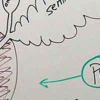 Inflamación próstática