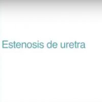 Estenosis de uretra