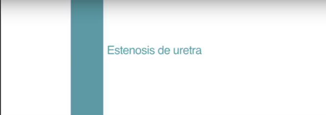 Estenosis de uretra