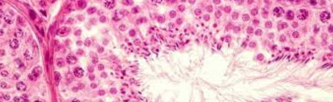 Biopsia Testicular