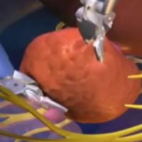 Datos cáncer próstata