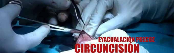 circuncisión