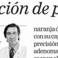 articulo enucleacion de prostata 2