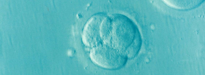 varicocele y fertilidad